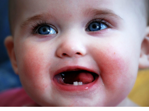 Trẻ 4 tháng mọc răng có sao không? Mọc sớm bố mẹ khó làm ăn phải?